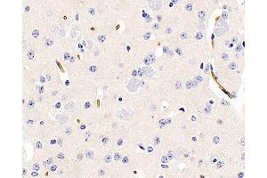 Immunohistochemistry analysis of paraffin-embedded Mouse brain using AQP1 Polyclonal Antibody at dilution of 1:400. (Aquaporin 1 抗体)