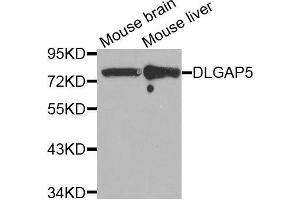 Western blot analysis of extracts of various tissues, using DLGAP5 antibody. (DLGAP5 抗体  (AA 547-846))
