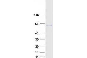 Fibulin 3 (FBLN3) (Transcript Variant 3) protein (Myc-DYKDDDDK Tag)