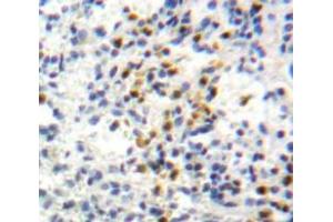 Used in DAB staining on fromalin fixed paraffin-embedded Spleen tissue (GPI 抗体  (AA 335-558))