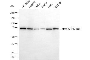 Western blotting analysis using ADAMTS8 antibody (ABIN7797506).