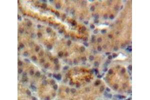 IHC-P analysis of Kidney tissue, with DAB staining. (CST5 抗体  (AA 21-142))