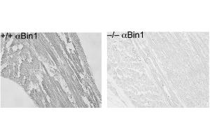 Immunohistochemistry of Mouse Anti-BIN1 antibody. (BIN1 抗体)
