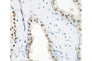 Immunohistochemistry of paraffin-embedded Human prostate using SF3B3 Polyclonal Antibody at dilution of 1:200 (40x lens). (SF3B3 抗体)