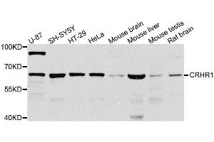 Western Blotting (WB) image for anti-Corticotropin Releasing Hormone Receptor 1 (CRHR1) (AA 24-120) antibody (ABIN6139034)