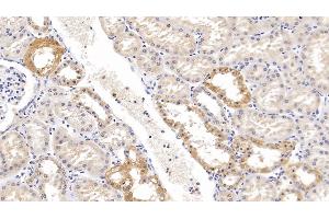 Detection of KLK1 in Human Kidney Tissue using Polyclonal Antibody to Kallikrein 1 (KLK1) (Kallikrein 1 抗体  (AA 25-261))