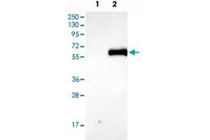 Western blot analysis of Lane 1: Negative control (vector only transfected HEK293T lysate), Lane 2: Over-expression Lysate (Co-expressed with a C-terminal myc-DDK tag (~3. (AGT 抗体)