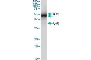 Immunoprecipitation of MAPKAPK2 transfected lysate using anti-MAPKAPK2 MaxPab rabbit polyclonal antibody and Protein A Magnetic Bead , and immunoblotted with MAPKAPK2 MaxPab rabbit polyclonal antibody (D01) . (MAPKAP Kinase 2 抗体  (AA 1-400))