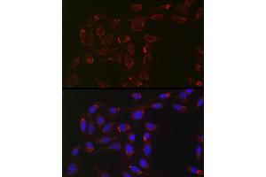 Immunofluorescence analysis of U2OS cells using  Rabbit mAb (ABIN7265367) at dilution of 1:100 (40x lens). (ACAA2 抗体)