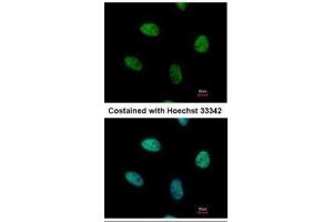 ICC/IF Image Immunofluorescence analysis of paraformaldehyde-fixed HeLa, using NUR77, antibody at 1:500 dilution. (NR4A1 抗体  (C-Term))