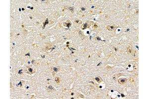 ABIN7096729 and ABIN7100794 at 1/100 staining mouse brain tissue by IHC-P. (ZNF382 抗体)