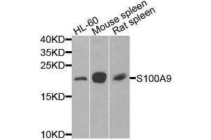 Western blot analysis of extracts of various cell lines, using S100A9 antibody.