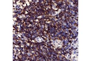 Immunohistochemistry of paraffin embedded human tonsil using CD3 (ABIN7073386) at dilution of 1: 1000 (400x lens) (CD3 抗体)