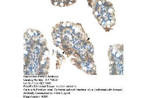 Human Intestine (PARP6 抗体  (C-Term))