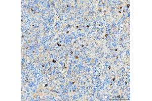 IHC analysis of Alpha Internexin using anti-Alpha Internexin antibody (ABIN4886634).