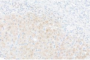 Immunohistochemistry (IHC) image for anti-Nicotinamide phosphoribosyltransferase (NAMPT) (AA 400-450) antibody (ABIN7454619) (NAMPT 抗体  (AA 400-450))