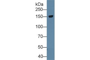 Western Blot; Sample: Rat Cerebrum lysate; Primary Ab: 1µg/ml Rabbit Anti-Rat TNR Antibody Second Ab: 0. (Tenascin R 抗体  (AA 329-588))
