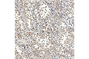 IHC analysis of SNRNP40 using anti-SNRNP40 antibody (ABIN7601719). (SNRNP40 抗体  (AA 43-357))