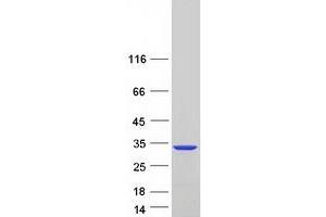 Validation with Western Blot