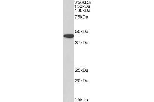 ABIN2613380 (0. (AMACR 抗体  (AA 312-326))