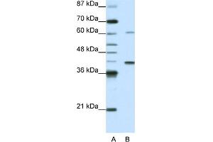 WB Suggested Anti-MGC46336 Antibody Titration:  0. (ZNF843 抗体  (N-Term))