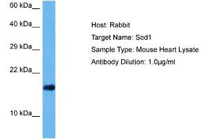 Host: Mouse Target Name: SOD1 Sample Tissue: Mouse Heart Antibody Dilution: 1ug/ml (SOD1 抗体  (C-Term))