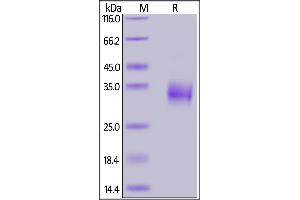 SARS-CoV-2 S protein RBD, His Tag on  under reducing (R) condition.