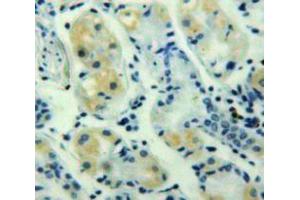 Used in DAB staining on fromalin fixed paraffin-embedded Stomach tissue (GRO gamma 抗体  (AA 35-107))