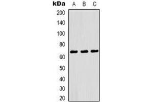 Western blot analysis of NF-kappaB p65 expression in Hela (A), mouse spleen (B), rat heart (C) whole cell lysates. (NF-kB p65 抗体)