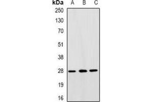 Western blot analysis of TFIIF RAP 30 expression in SW480 (A), HepG2 (B), A549 (C) whole cell lysates. (GTF2F2 抗体)