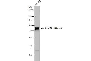WB Image p75 NGF Receptor antibody detects p75 NGF Receptor protein by western blot analysis. (NGFR 抗体)