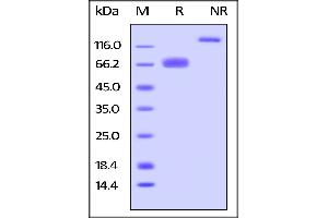 Mouse LILRB4, Fc Tag on  under reducing (R) and ing (NR) conditions. (LILRB4 Protein (AA 24-238) (Fc Tag))