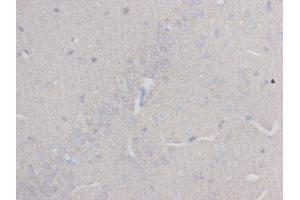 Immunohistochemistry (IHC) image for anti-Tubulin, beta 3 (TUBB3) (N-Term) antibody (ABIN1854950)