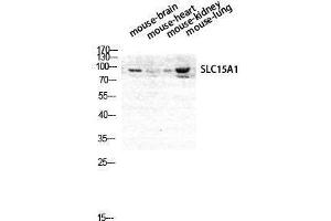 Western Blotting (WB) image for anti-Solute Carrier Family 15 (Oligopeptide Transporter), Member 1 (SLC15A1) (Internal Region) antibody (ABIN3176831) (SLC15A1 抗体  (Internal Region))