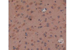 IHC-P analysis of brain tissue, with DAB staining. (Oligophrenin 1 抗体  (AA 634-802))