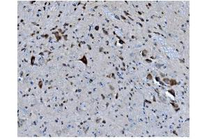 IHC analysis of MAPK1 using anti-MAPK1 antibody (ABIN7600772). (MAPK11 抗体  (AA 230-364))