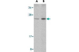 Western blot analysis of DDIT4 in human kidney tissue lysate with DDIT4 polyclonal antibody  at (A) 0. (DDIT4 抗体  (Internal Region))