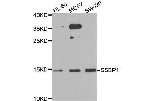 Western blot analysis of extracts of various cell lines, using SSBP1 antibody (ABIN5974202) at 1/1000 dilution. (SSBP1 抗体)