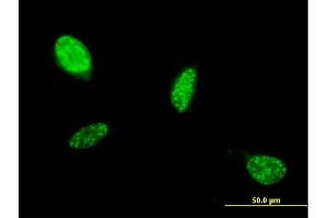 Immunofluorescence of monoclonal antibody to ATOH1 on HeLa cell. (ATOH1 抗体  (AA 266-354))