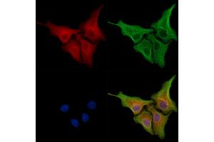 ABIN6261584 and ABIN6278325 staining Hela cells by IF/ICC. (ERAP1 抗体  (Internal Region))