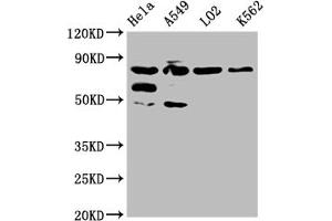 Western Blot Positive WB detected in: Hela whole cell lysate, A549 whole cell lysate, L02 whole cell lysate, K562 whole cell lysate All lanes: MTRR antibody at 1:2000 Secondary Goat polyclonal to rabbit IgG at 1/50000 dilution Predicted band size: 81, 78, 7 kDa Observed band size: 81 kDa (MTRR 抗体  (AA 1-725))
