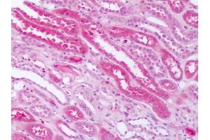 Human Kidney: Formalin-Fixed Paraffin-Embedded (FFPE) (SMO 抗体  (N-Term))