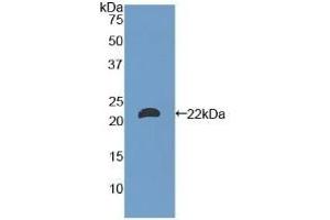 Detection of Recombinant LAMa1, Mouse using Polyclonal Antibody to Laminin Alpha 1 (LAMA1) (Laminin alpha 1 抗体  (AA 2640-2773))