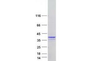 Validation with Western Blot