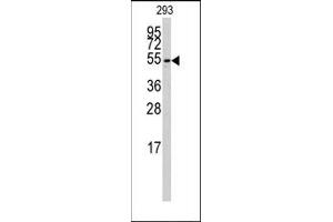 Image no. 1 for anti-Cytochrome P450, Family 26, Subfamily B, Polypeptide 1 (CYP26B1) (C-Term) antibody (ABIN360415) (CYP26B1 抗体  (C-Term))