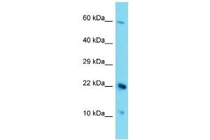 Host: Rabbit Target Name: C17orf105 Sample Type: HepG2 Whole Cell lysates Antibody Dilution: 1. (C17ORF105 抗体  (Middle Region))