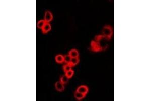 Immunofluorescent analysis of MALT1 staining in U2OS cells. (MALT1 抗体)