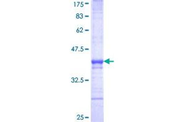 MAF Protein (AA 304-403) (GST tag)