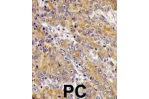 Immunohistochemistry (IHC) image for anti-Myosin ID (MYO1D) antibody (ABIN3002631) (Myosin ID 抗体)
