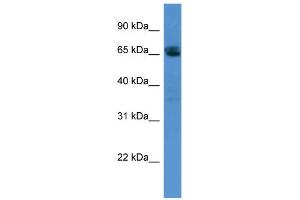WB Suggested Anti-SMARCD3 Antibody Titration:  0. (SMARCD3 抗体  (N-Term))